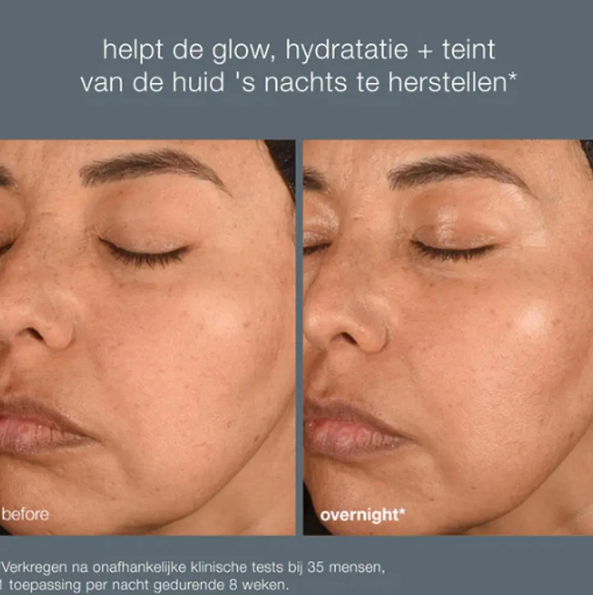 Dermalogica BioLumin-C Night Restore Kopen