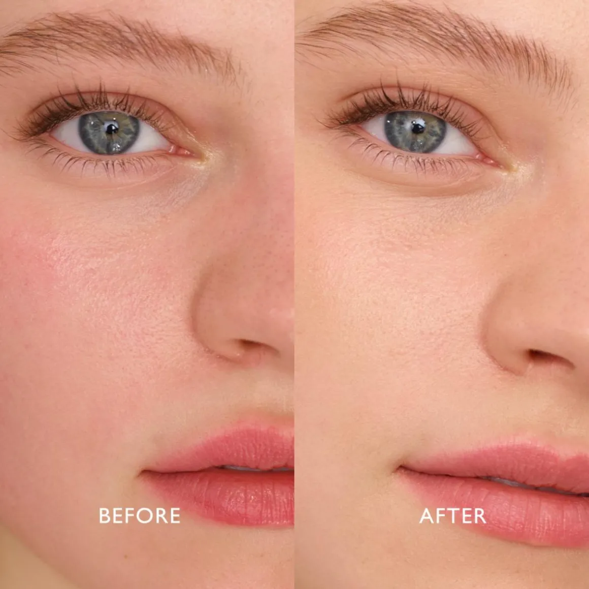 Infinite Bronze Tinted Protection Sunlight