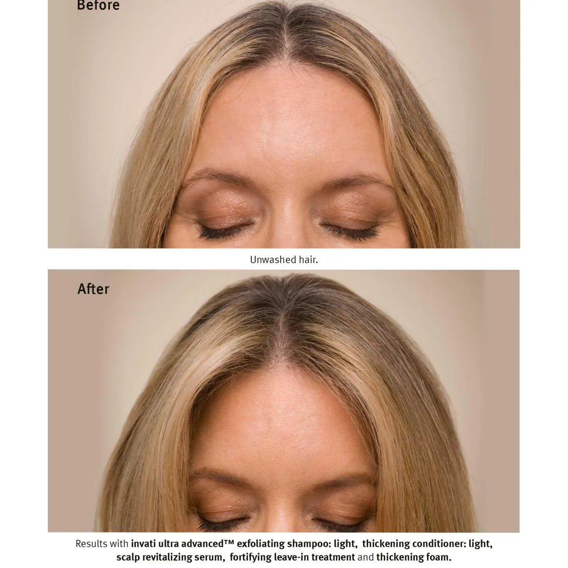 Invati Ultra Advanced Revitalizing Scalp