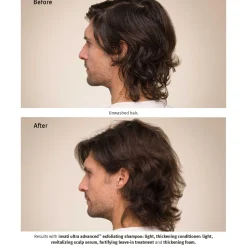 Invati Ultra Advanced Thickening Kopen