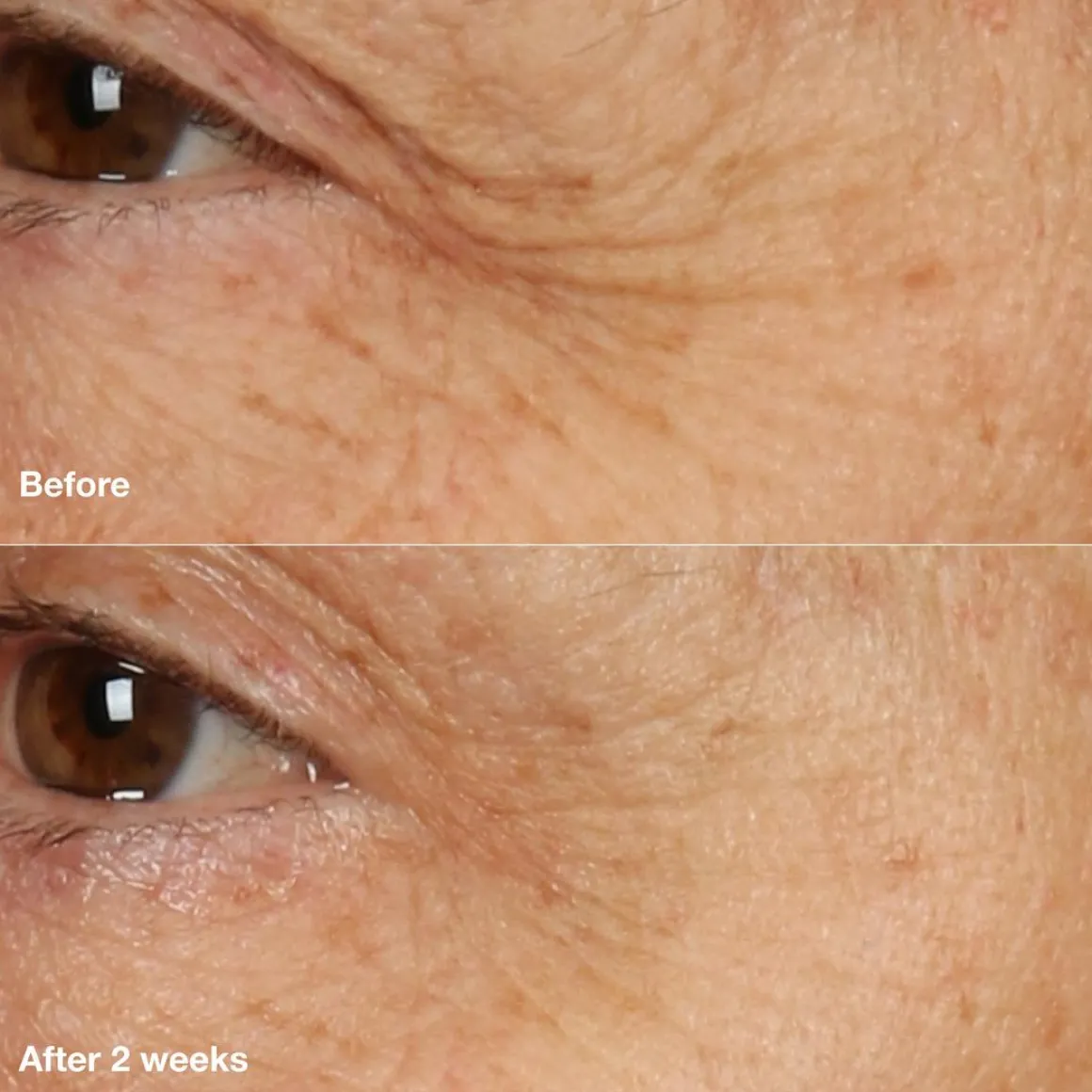 Smart Clinical Repair Overnight Recovery