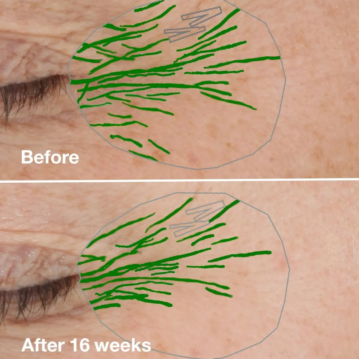 Smart Clinical Repair Wrinkle Correcting