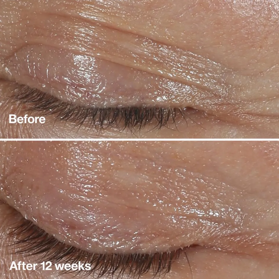 Smart Clinical Repair Wrinkle Eye Cream